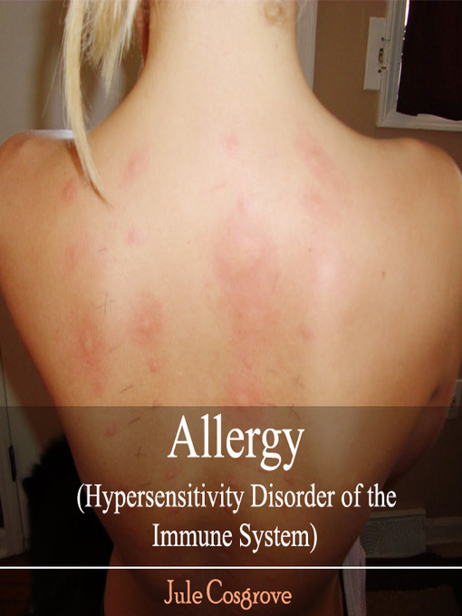 Title details for Allergy by Jule Cosgrove - Available